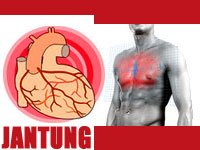 Mengatasi Sakit Jantung dan Serangan Jantung