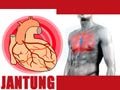 Mengatasi Sakit Jantung dan Serangan Jantung