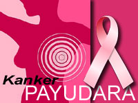 Hadapi Kanker Payudara
