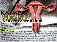 Kanker Serviks Pembunuh Banyak Wanita
